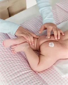 bebe com alergia a fralda que pomada usar
